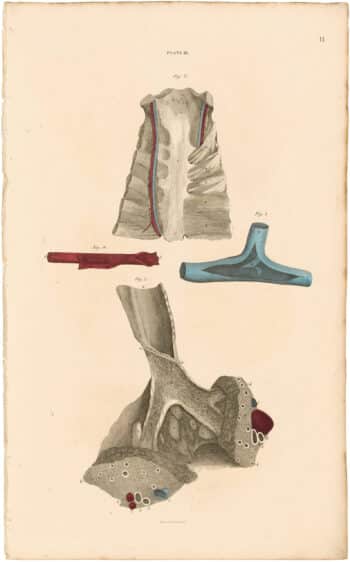 Lizars Pl. 11, The Trachea and Lungs, with...