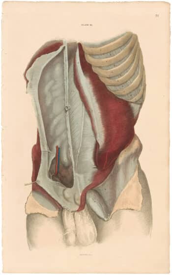 Lizars Pl. 31, View of the still more deeply-seated Abdominal...