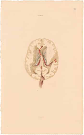 Lizars Pl. 60, Lateral ventricles cut open...