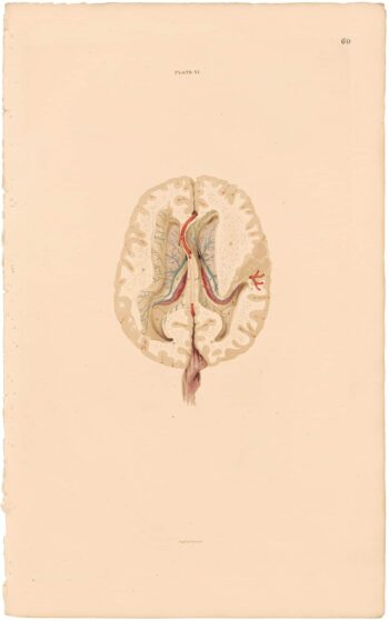Lizars Pl. 60, Lateral ventricles cut open...