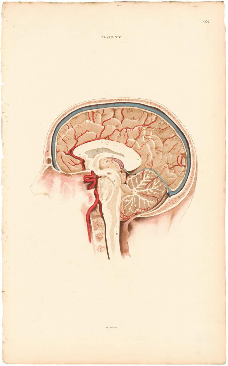 Lizars Pl. 68, Perpendicular Section of the Cerebrum...