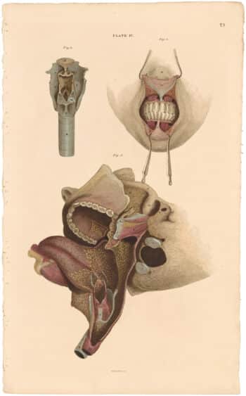 Lizars Pl. 73, View of the Muscles and Cartilages...