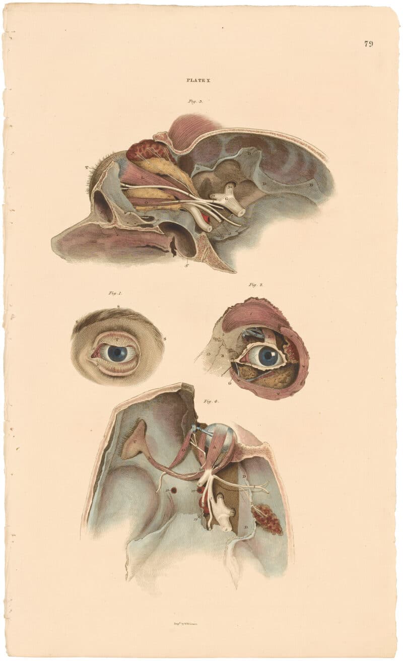 Lizars Pl. 79, Exhibits Four Views of the Eye