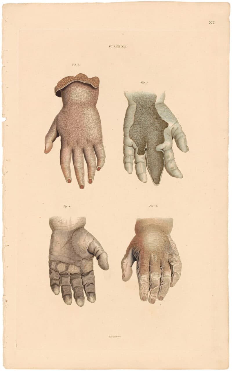 Lizars Pl. 82, Represents four views of the Organ of Touch