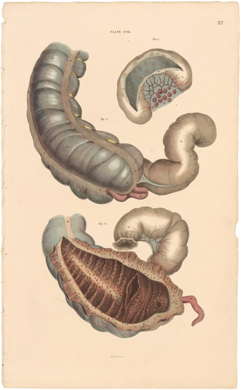Lizars Pl. 87, The structure of the Ileum and Colon represented