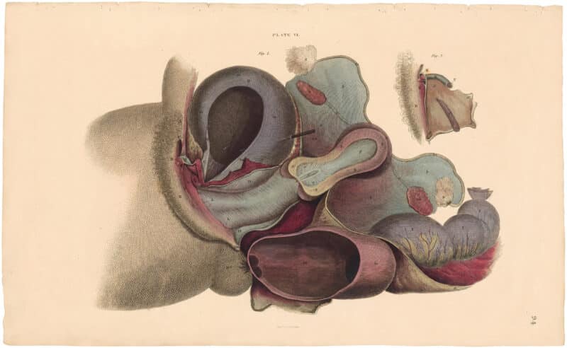 Lizars Pl. 94, Illustrates the Structure of the Urinary Bladder